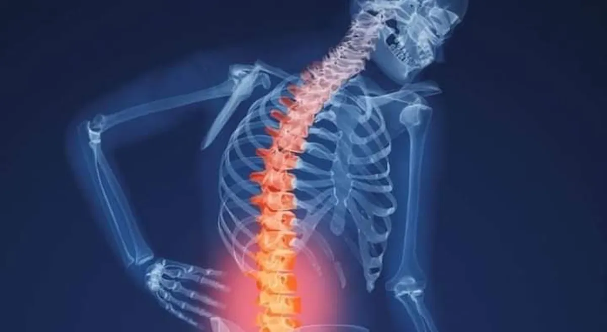 IMSS da tips para mantener postura correcta de la columna