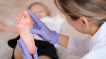 Autoridades de salud vigilan brotes de enfermedad de manos, pies y boca en Hidalgo.