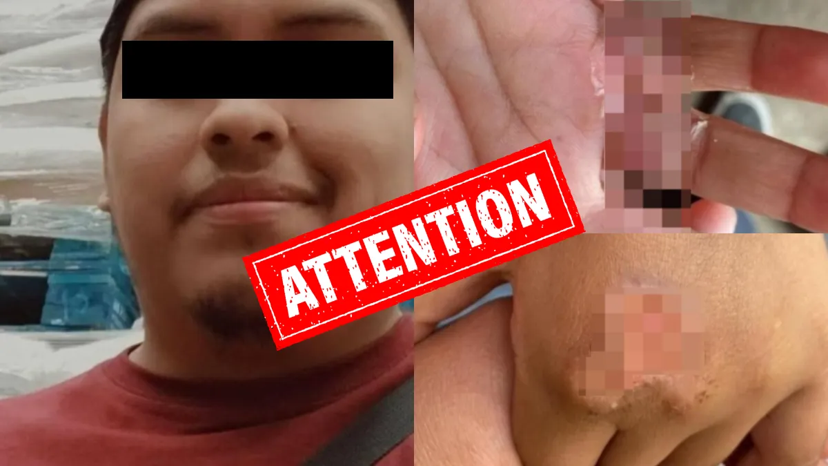 Queman manos a menores en Los Reyes La Paz; padrastro y madre detenidos por maltrato. Los niños de 4 y 6 años fueron rescatados por la FGJEM.