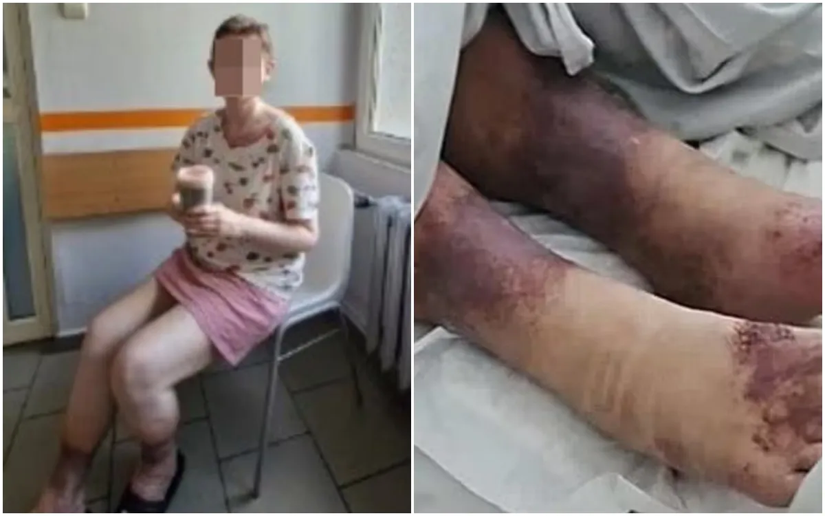 Mirella fue encontrada con vida tras 27 años encerrada en su casa en Polonia.