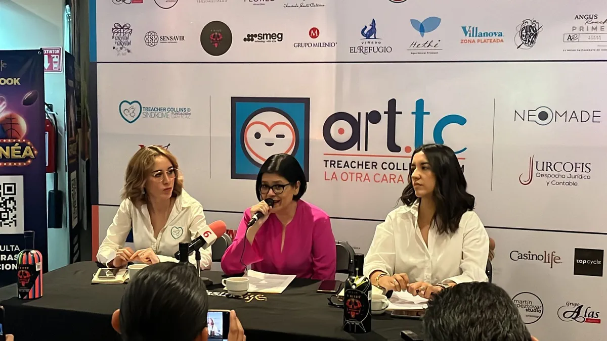 Tratamiento para síndrome de Treacher Collins: ¡12 hidalguenses necesitan ayuda!