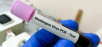 Viruela del mono: expertos alertan por mutación del virus