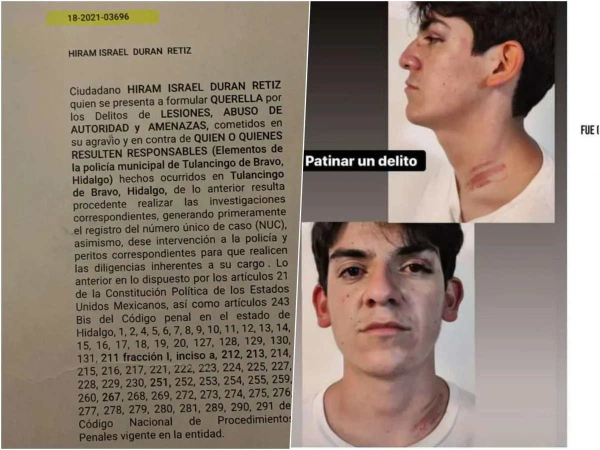 Alcalde de Tulancingo responde a video que evidenció detención arbitraria de dos jóvenes