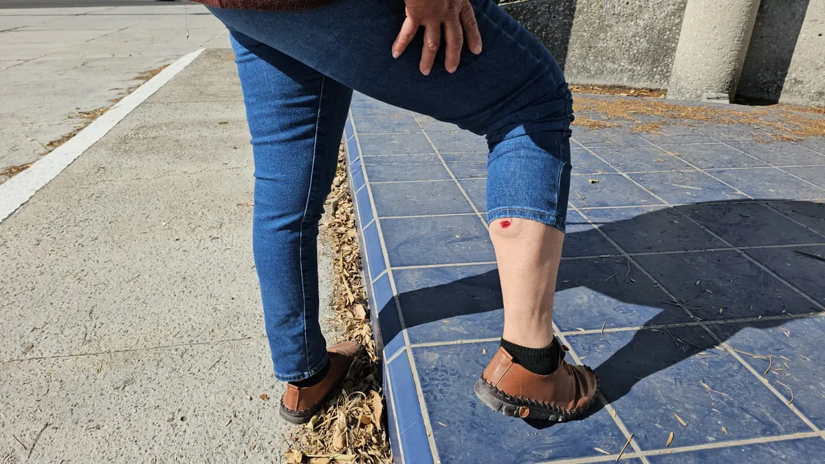 Periodista lesionada