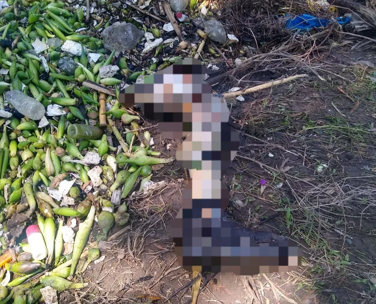 Hallan extremidad humana en Tezontepec de Aldama