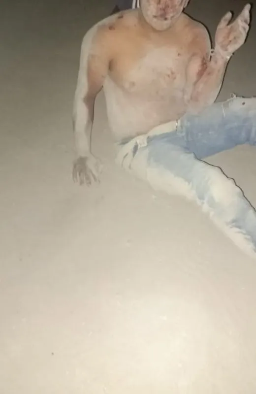 Lo confunden con ladrón de autos e intentan lincharlo en Ixmiquilpan