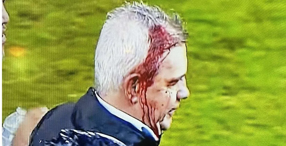 Afición de Honduras descalabra a Javier Aguirre