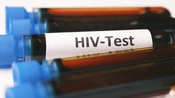 VIH test