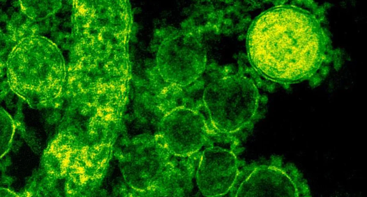 Viruela del mono: ¿qué es y cuáles son los síntomas?