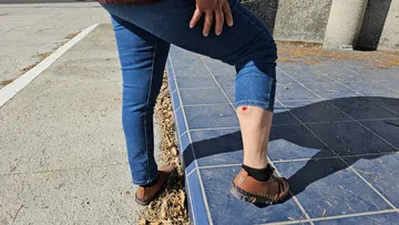 Periodista lesionada
