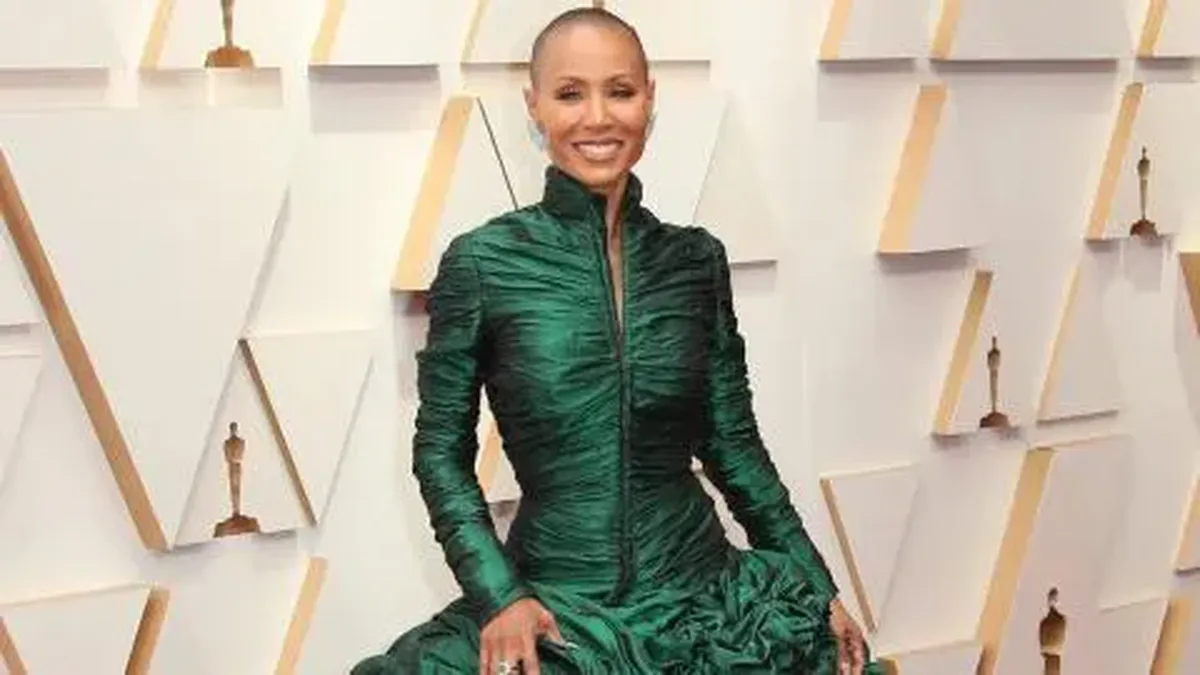 ¿Qué es la alopecia?, mujeres famosas que se afeitaron la cabeza