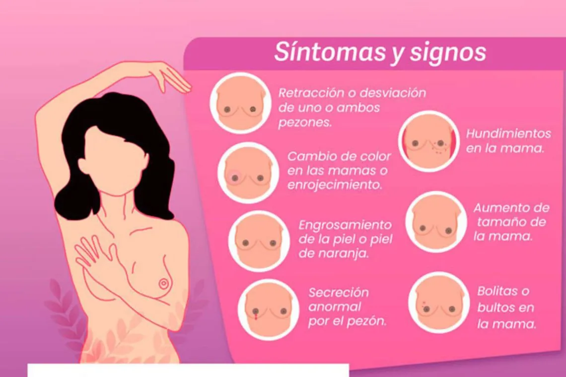 Cáncer de mama: lo que toda mujer debe saber para detectarlo a tiempo