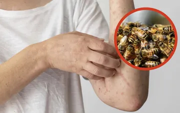 Enjambre de abejas ataca a pobladores de Ixmiquilpan y Cardonal