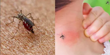 Dengue aumenta en Hidalgo pese a esfuerzos de prevención: ve municipios con más casos