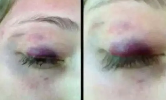 Nieto de Murillo Karam acusado por tentativa de homicidio