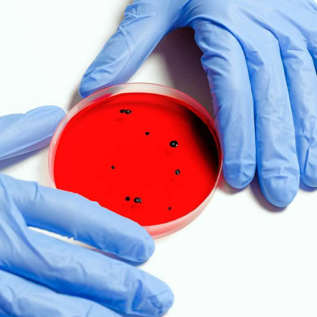 Henipavirus, el nuevo virus de origen animal detectado en humanos en China