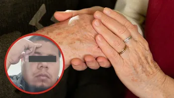 Autoridades atienden el caso de una pareja de adultos mayores agredida en Xochiatipan.