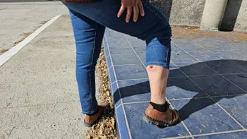 Periodista lesionada