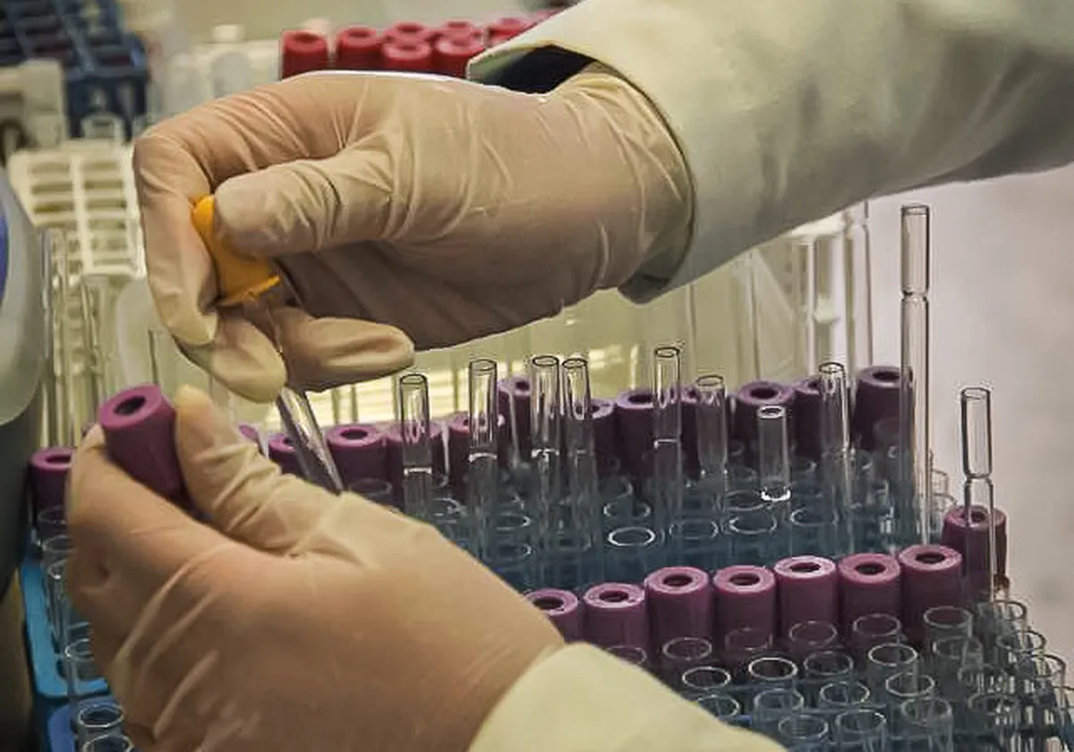 Este año en Hidalgo se han diagnosticado 11 casos de Chagas