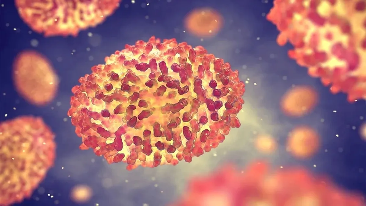 Que es es la viruela del mono