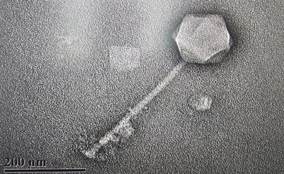 Laboratorio afirma haber inyectado por primera un virus diseñado con IA a un humano