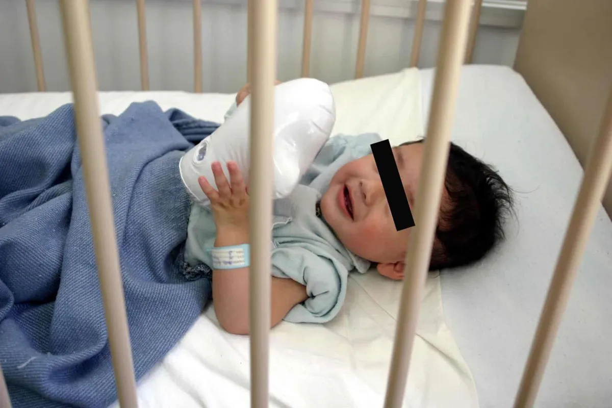 Hepatitis Aguda Infantil: sin más casos en Hidalgo, hay 12 de tipo A