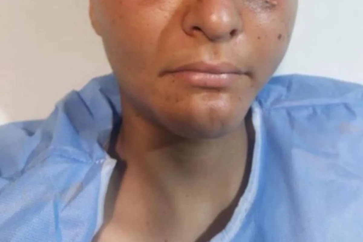 La familia ha dejado la zona rural para mudarse a la ciudad y buscar el apoyo médico que requiere su hijo