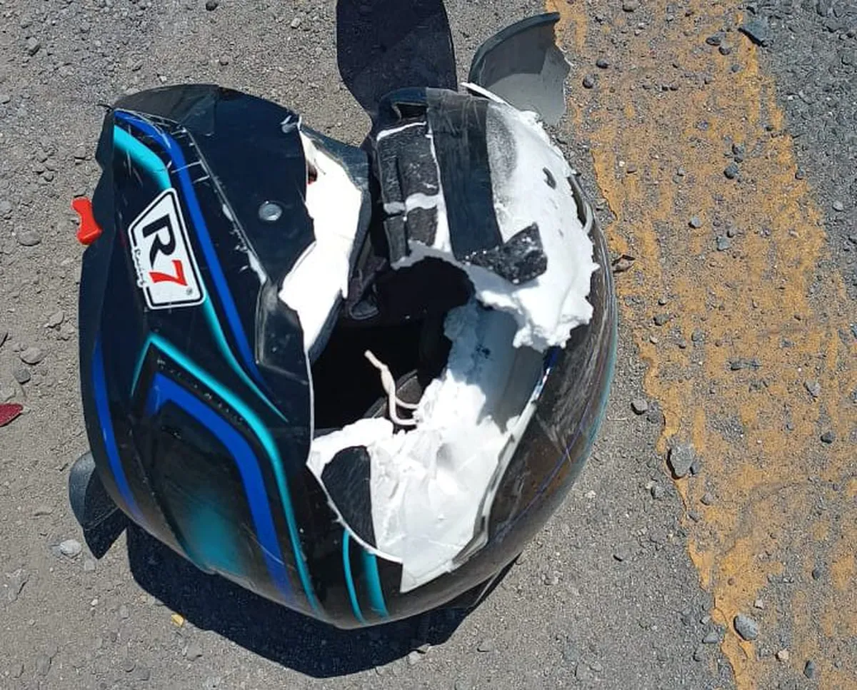 Accidente en Ixmiquilpan: motociclista con múltiples fracturas tras ser impactado por auto