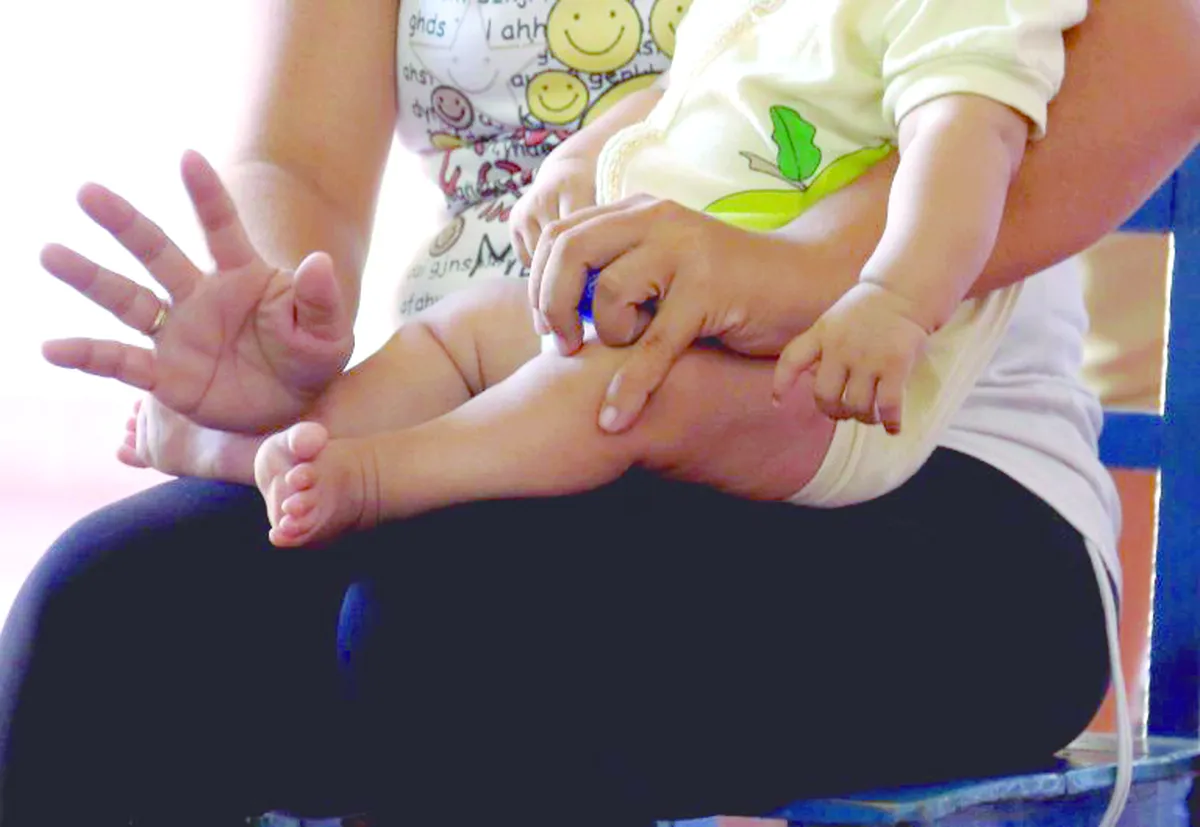 Hidalgo: quinto en incidencia de defectos al nacimiento