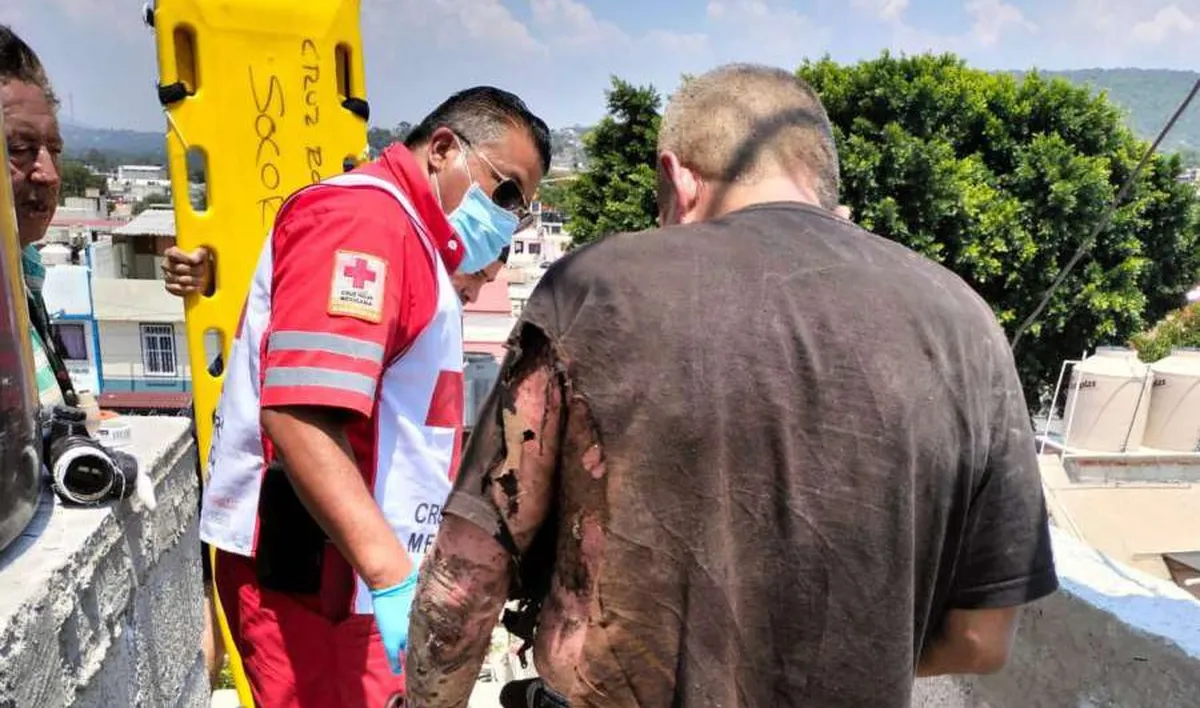 Hombres se electrocutan en Tula; resultan con quemaduras