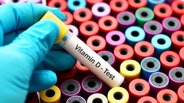 Más de una tercera parte de los mexicanos tiene deficiencia de vitamina D sin saberlo.