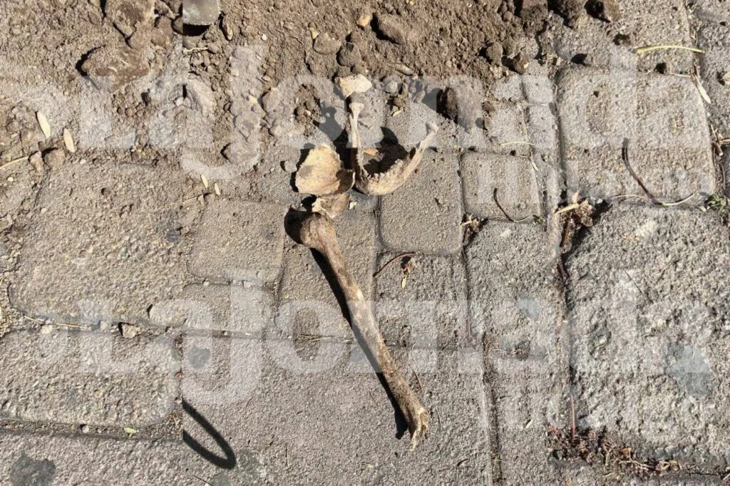 Localizan presuntos restos humanos frente a centro de salud en Pachuca