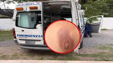 Registran ataque de araña violinista en Tecozautla
