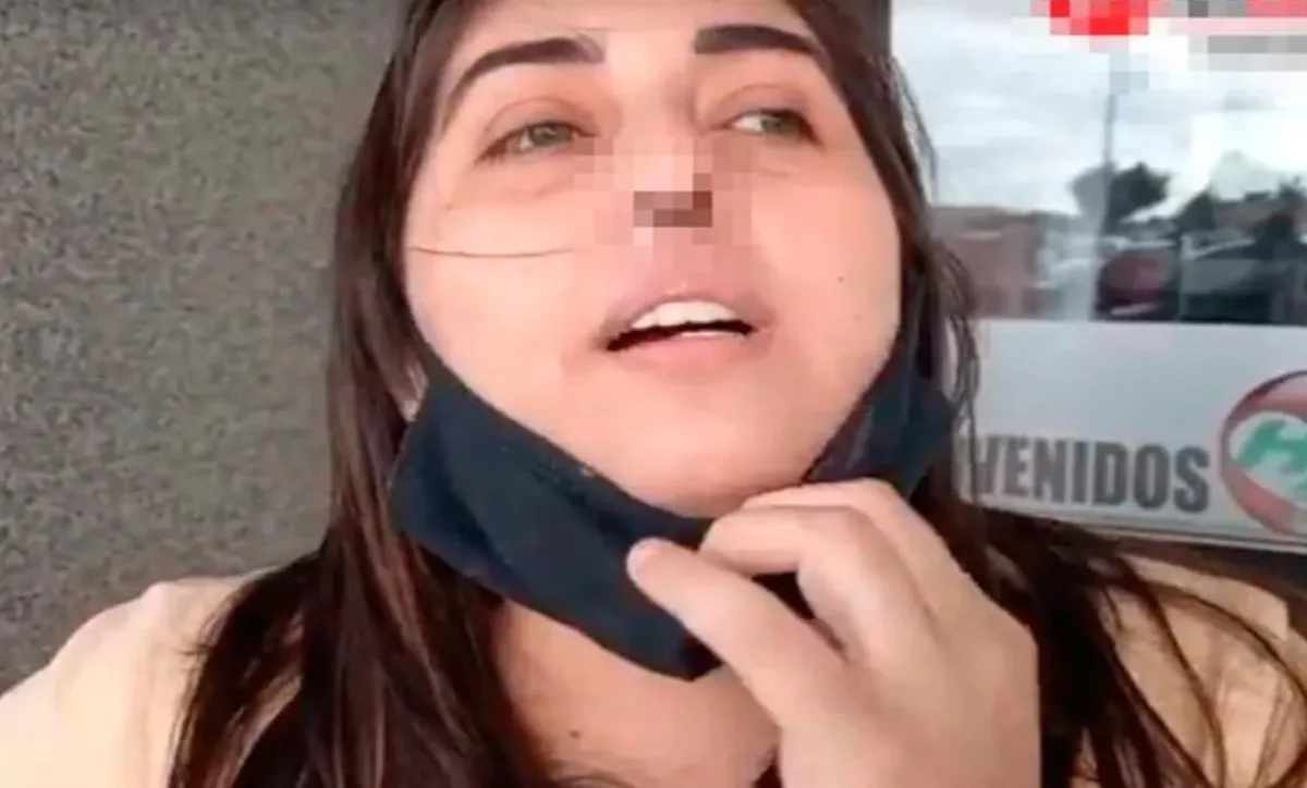 Una mujer perdió el cartílago de su nariz por una prueba PCR de Covid