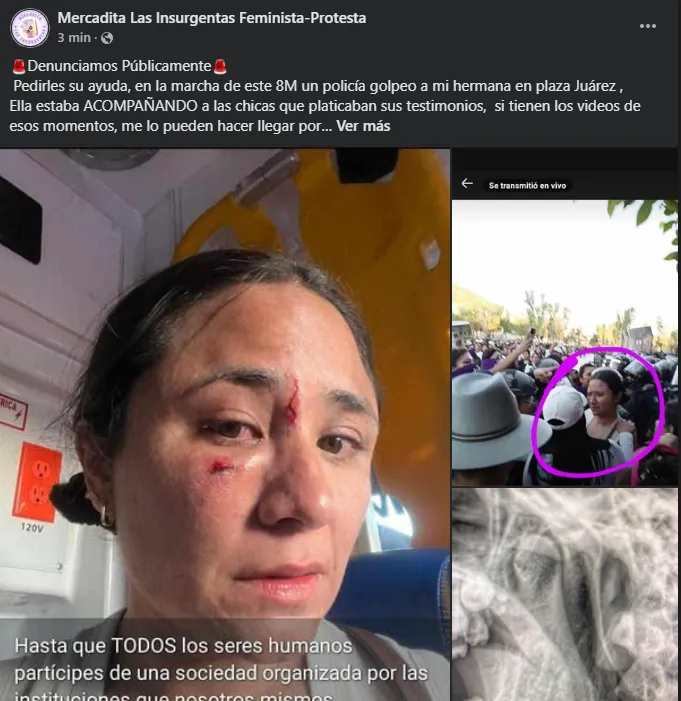 Mujer denuncia agresión policial en marcha del 8M en Pachuca