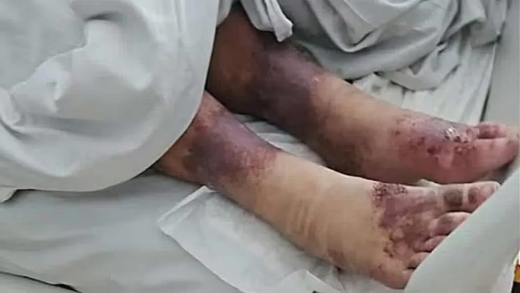 Encerrada 27 años: hallan con vida a Mirella, la joven que desapareció en 1998 en Polonia